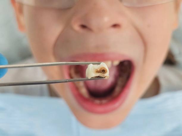 Best Mobile Emergency Dentist in Bull Run Mountain Estates, VA