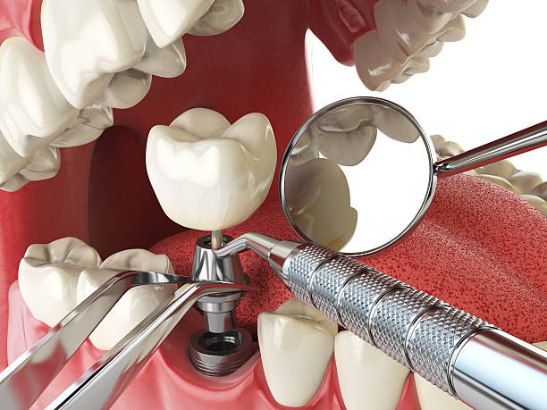 Best Emergency Dental Care for Abscessed Tooth in Bull Run Mountain Estates, VA